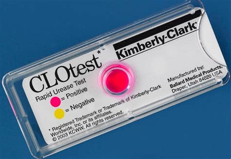 kimberly clark clo test package insert|bjc clo test positive.